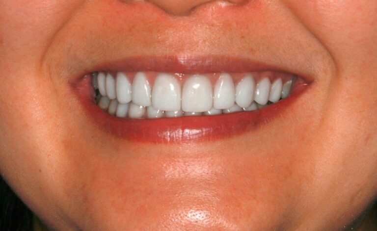 Konig Center for Cosmetic & Comprehensive Dentistry smile photos